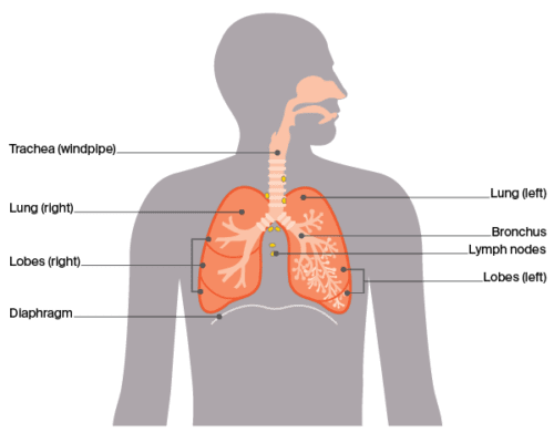 Lung cancer - Aboriginal and Torres Strait Islander Cancer Website